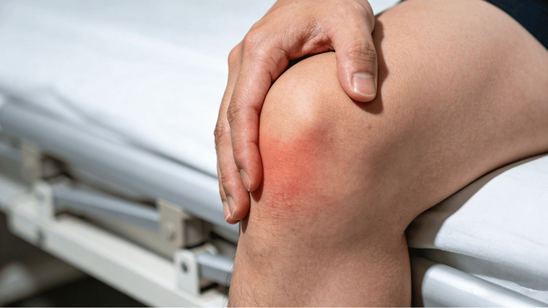 膝蓋骨前滑囊炎(Prepatellar Bursitis)